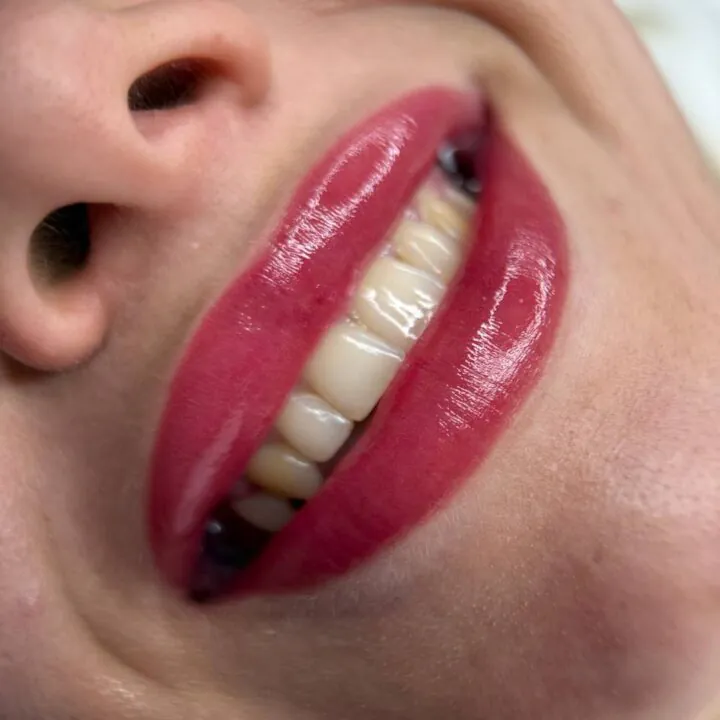 Permanent lip makeup — result